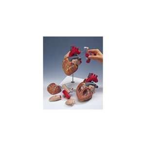 PT# SB41433U Giant Heart with Esophagus and Trachea by Nasco (sold 