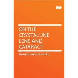   On the Crystalline Lens and Cataract Bernard Edward Brodhurst Books