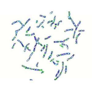  Human Chromosomes Changed to Z087 N 761 Photographic 