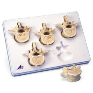    3B Scientific Set of 5 Lumbar Vertebrae