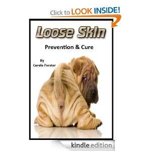 Loose Skin Carole Forster  Kindle Store